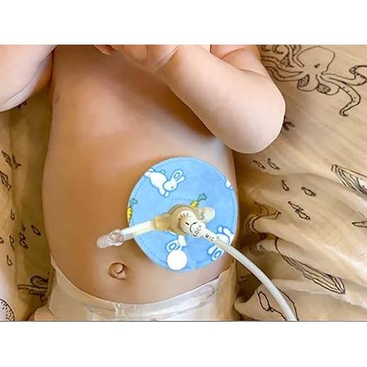 Stickdatei Sondenpad G Tube Pads Set 2611 – In the Hoop Maschinenstickerei für Gastrostomie-Tube Covers Bild 2