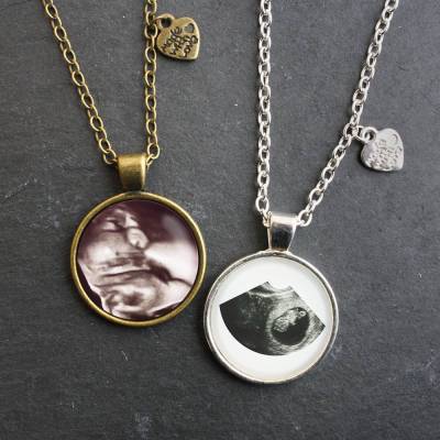 Personalisierte Kette – Ultraschallbild / Foto 